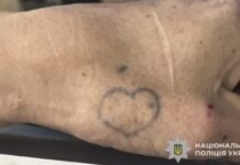 У Синельниківському районі жінку насмерть збило авто: поліція встановлює особу та шукає свідків події