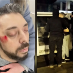 У Дніпрі чоловік впав у кому після «зустрічі» з працівниками ТЦК на проспекті Науки: офіційний коментар