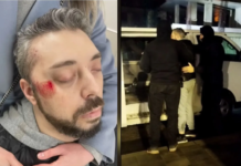 У Дніпрі чоловік впав у кому після «зустрічі» з працівниками ТЦК на проспекті Науки: офіційний коментар