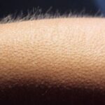 Чому виникають «мурашки по шкірі»: пояснення реакції організму