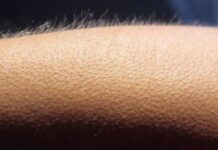 Чому виникають «мурашки по шкірі»: пояснення реакції організму