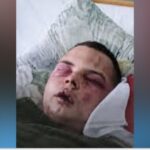 У Шахтарському військові «Вовків Да Вінчі» жорстоко побили та викрали 20-річного хлопця: суд відправив підозрюваних під варту