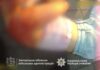 Правоохоронці Запоріжжя врятували дівчинку після ворожого удару
