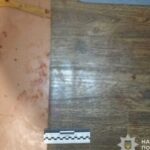 Сварка закінчилася спричиненням тяжких тілесних ушкоджень: у Нікополі правоохоронці затримали нападника