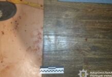 Сварка закінчилася спричиненням тяжких тілесних ушкоджень: у Нікополі правоохоронці затримали нападника